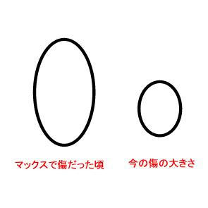 Picture1.jpg