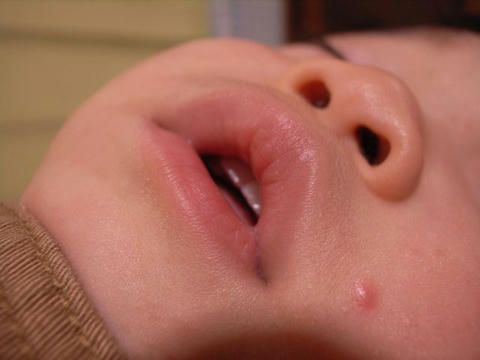 歯