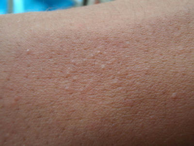 P5200259op21.jpg