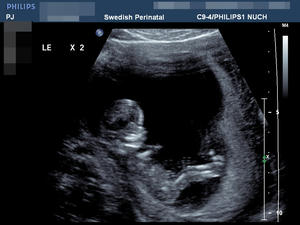ultrasoundpics2.jpg
