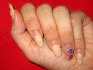 nail1