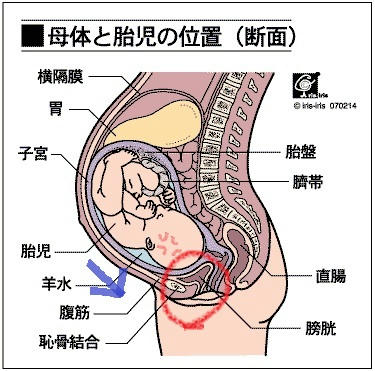chikotsu2