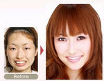 makino1