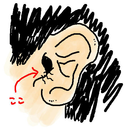 きもい毛