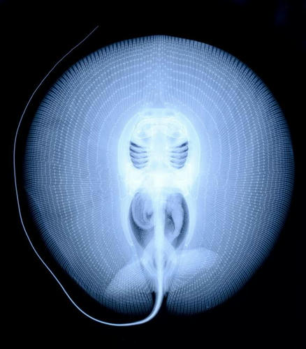 stingray-x-ray.jpg