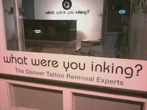 tattoo-removal-experts.jpg