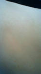 hadaare-100126.jpg