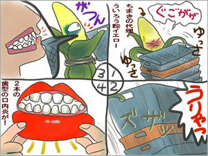 口内炎４コマ