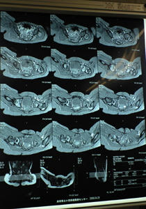MRI1.jpg