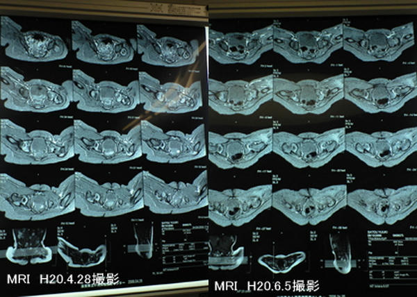 MRI.jpg