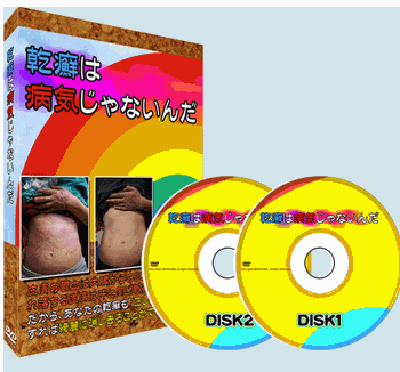 乾癬は病気じゃないんだ