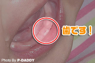 歯が生えた！