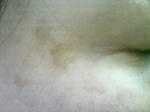 右シミ　2008/11/11　KIREI_SN342795.JPG