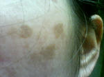 左シミ 2008/11/11 KIREI_SN342796.JPG