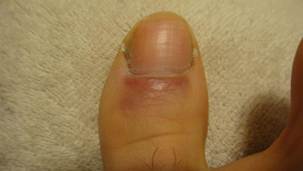 20120315.jpg