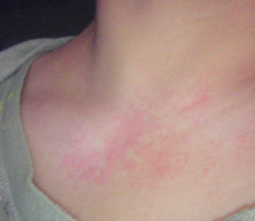 skin.jpg
