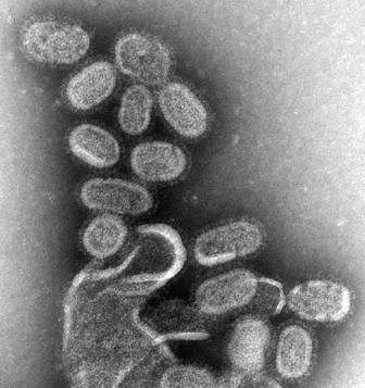EM_of_influenza_virus.jpg