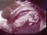１２ｗ５ｄ