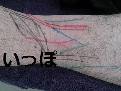 膝の触察