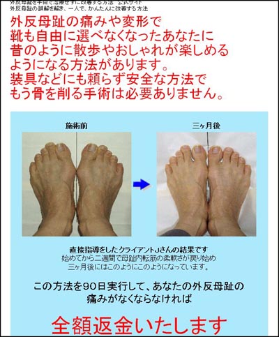 このサイトは、中村静雄さんの【中村式】外反母趾改善プログラム　◆外反母趾治療に手術はいらない！ 外反母趾の誤解を解き、一人で、かんたんに改善する方法の効果 内容 靴 治療 病院 テーピング 手術 矯正 サンダル 整形外科 痛み シューズ などの情報を公開しています。