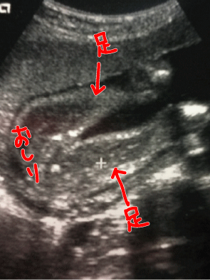 aa3e3041.gif