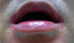 mouth_lip.jpg