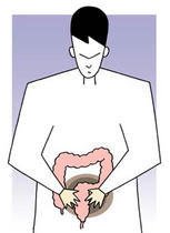 Large intestine cancer, Colonic cancer, Rectal cancer, Colitis, Large intestine disease