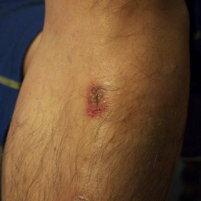 20111116_210236.jpg
