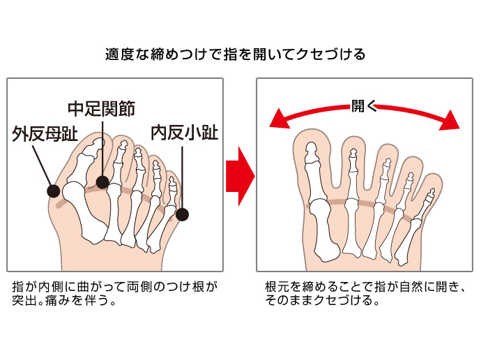 拡大鏡付き爪きりの構造