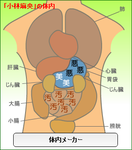 小林麻央体内メーカー