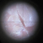 ピンクオパール