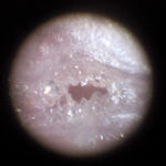 200倍ピンクオパール