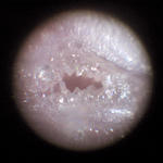 200倍ピンクオパール