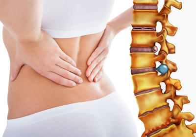 Phương pháp mổ thoát vị đĩa đệm