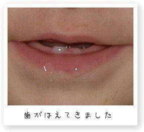 歯が生えてきた