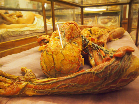 スペゴラ博物館人体解剖模型☆Anatomica☆アトラス スペゴラ博物館人体解剖模型☆Anatomica☆アトラス - メルカリ