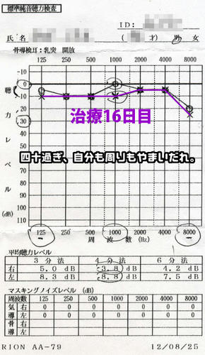 聴力検査