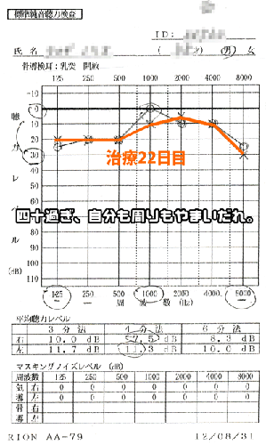 聴力検査