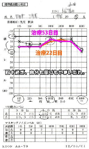 聴力検査