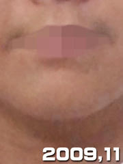 hige_20091127.jpg