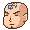 ハゲ