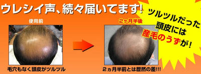 M 1育毛ミスト 効果 使い方やかゆみ副作用はどんな感じ 通販ショッピング好きな女子会ブログ