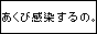 あくび感染同盟