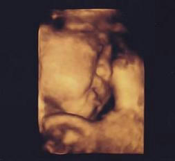 4Dエコー,超音波写真,妊娠検診,赤ちゃんの写真