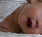 赤くなっちゃった首周り