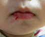 mouth