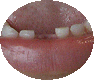 teeth1