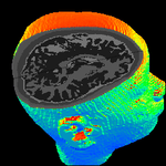 headmodel4_csf2voxel