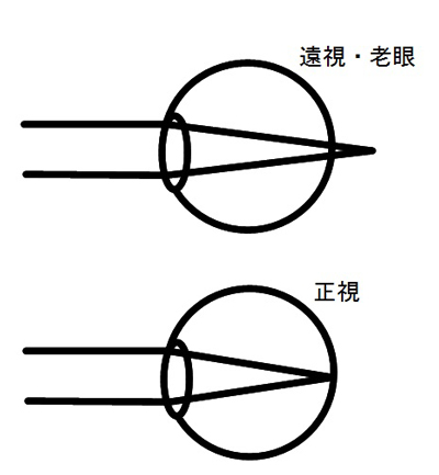 老眼、遠視、正視の場合の目の中の状態