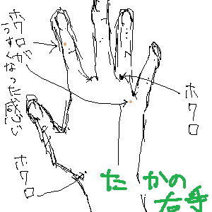 migite.png